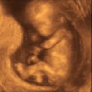 bebe com 4 meses na barriga