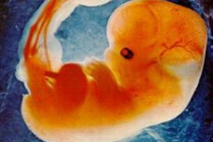 gravidez de 2 meses fotos - Gestação Bebê