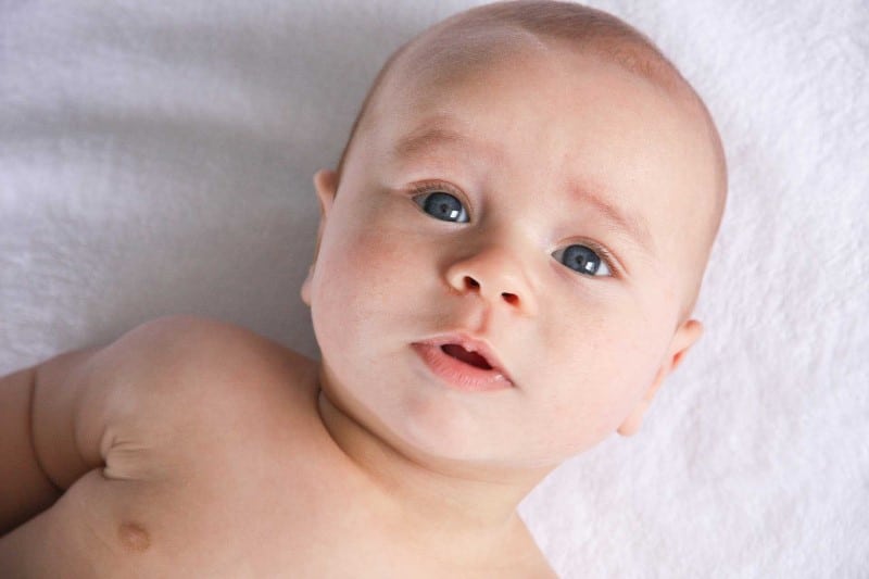 torcicolo congênito do bebê bebê tem torcicolo congenito