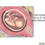 foto do bebe com 11 semanas