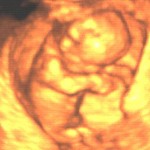 bebe 11° semana barriga