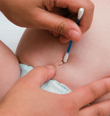Read more about the article Como cuidar do cordão umbilical do bebê
