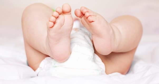Read more about the article Dicas para evitar e curar assaduras no bebê