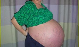 Mulher grávida de 13 gêmeos