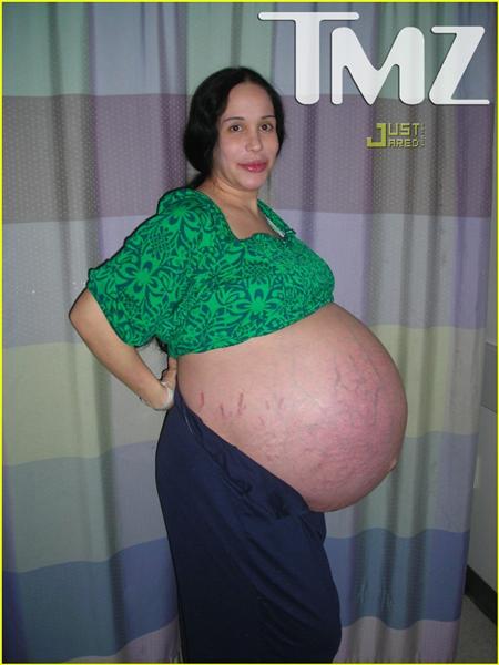 Read more about the article Mulher grávida de 13 gêmeos
