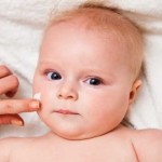 Doenças de pele comuns em bebês