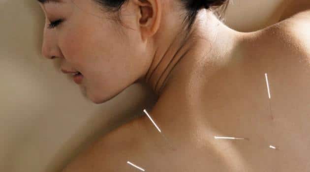 Read more about the article Conheça a acupuntura para o aleitamento