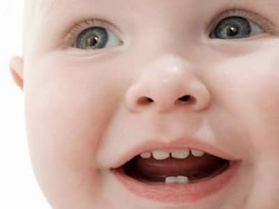 Read more about the article Quando levar o bebê pela primeira vez ao dentista?