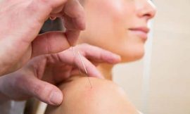 Benefícios da acupuntura na gestação