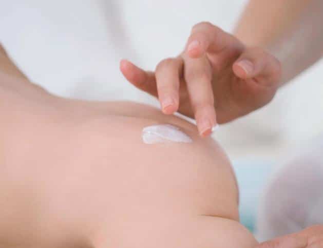 Read more about the article Como cuidar de irritação na pele do bebê
