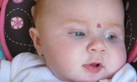 Hemangioma – Tratamento para marquinhas vermelhas na pele do bebê
