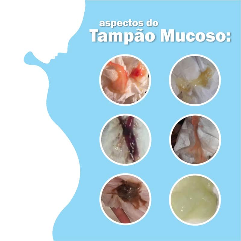 fotos tampão mucoso