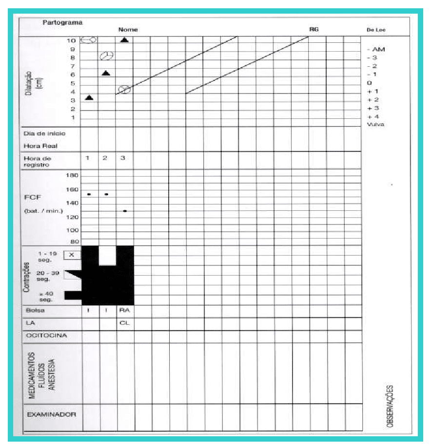 O que é um Partograma?