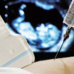 Amniocentese – Preço do Exame