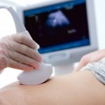 Ultrassom na gravidez: faz mal? Quando fazer?