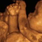 Ultrassom 4D – Quando fazer? Quanto custa?