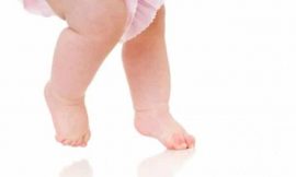 Bebê que anda na ponta dos pés