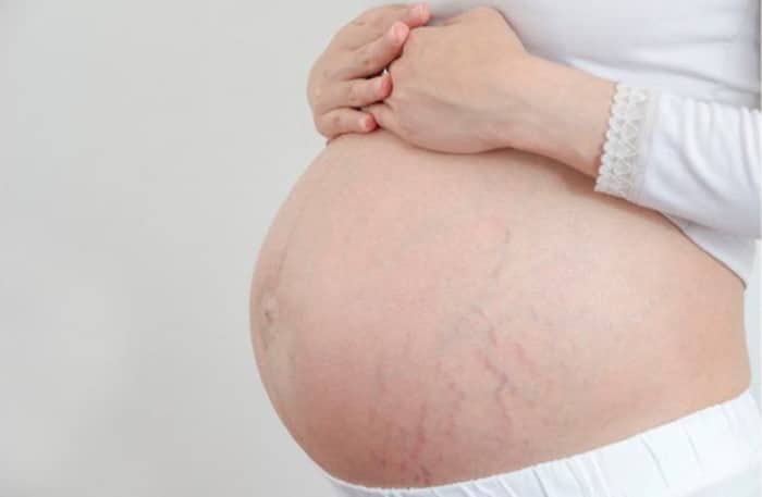 Read more about the article Cuidados com a barriga na gravidez