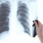 Efeitos da radiografia na gravidez