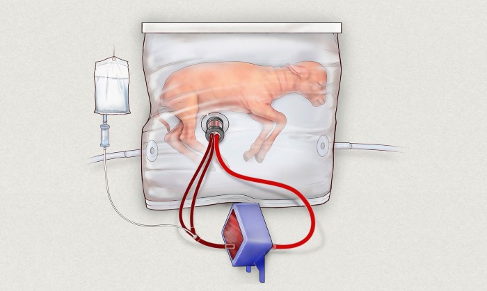 Cientistas desenvolvem útero artificial para ajudar bebês prematuros 