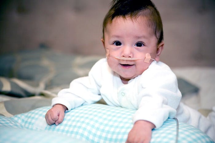 Read more about the article Bronquiolite em bebê: como tratar e curar
