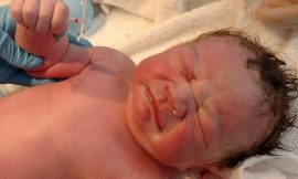 Imagem de recém-nascido segurando DIU viraliza na web