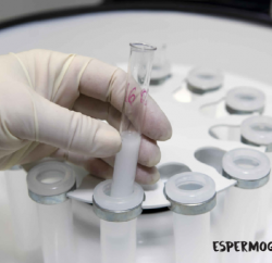 Preco exame espermograma