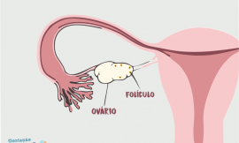 O que é folículo no ovário direito?