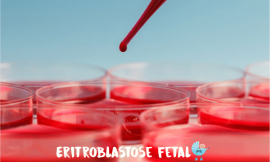 Eritroblastose Fetal: prevenção, diagnóstico, consequencias, complicações e tratamento