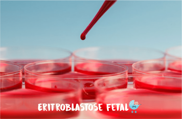 Read more about the article Eritroblastose Fetal: prevenção, diagnóstico, consequencias, complicações e tratamento