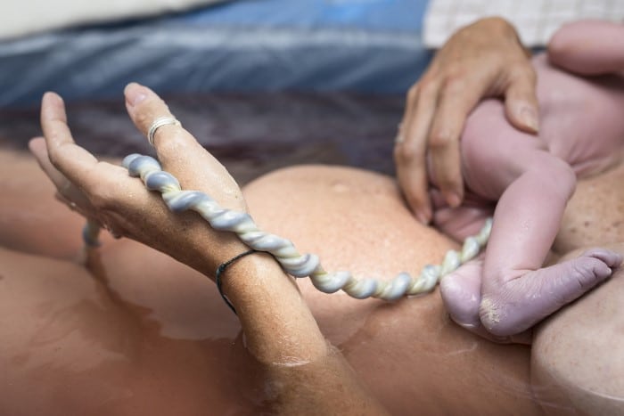 Read more about the article Como cortar o cordão umbilical do bebê?