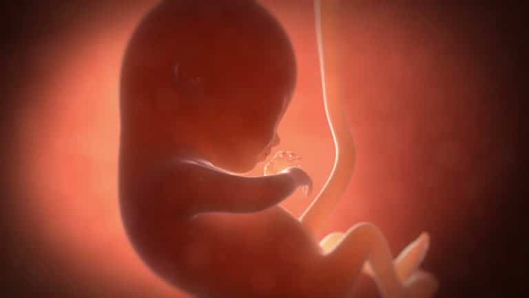 Feto de 3 meses