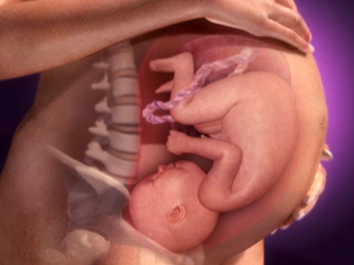  feto com 8 meses de gestação