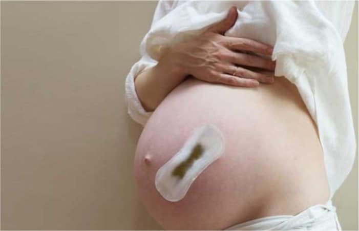 Read more about the article Corrimento verde na gravidez é normal?