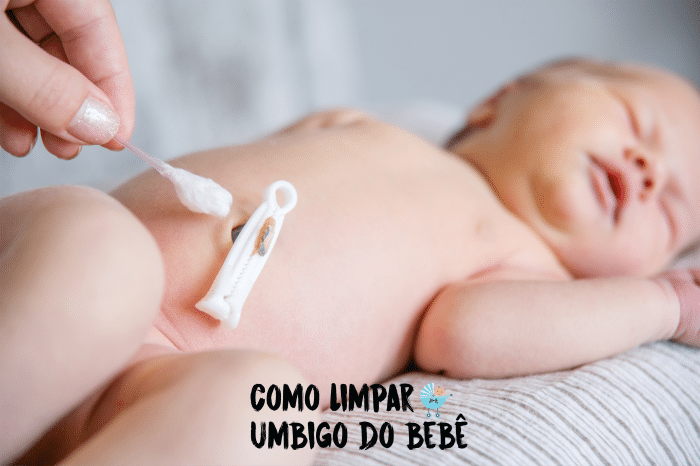 umbigo recem nascido inflamado