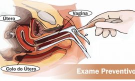 Exame Preventivo: Como é feito, para que serve, quando fazer, dói?