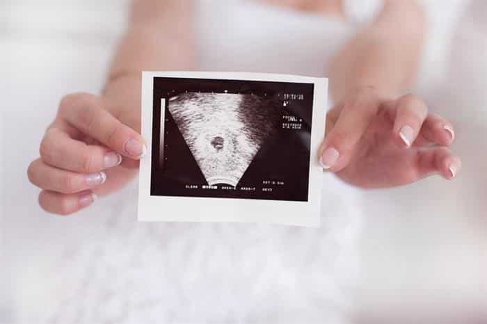 quando o embrião aparece no ultrassom