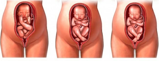 posição fetal