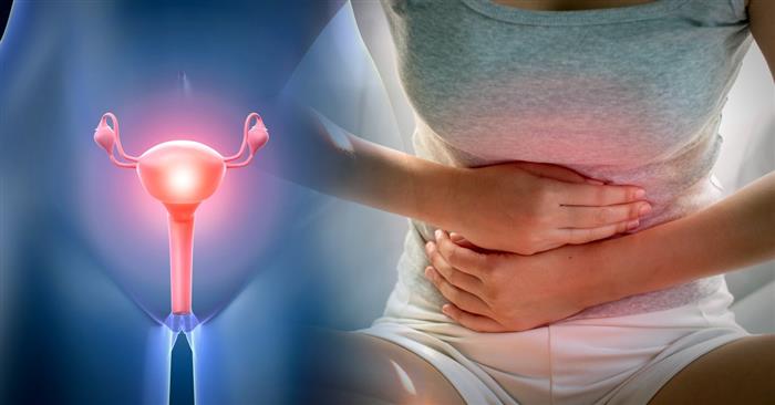 sintomas do prolapso uterino
