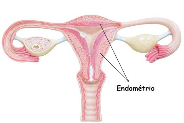 endométrio