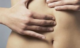 Diástase abdominal pós-parto: tratamento