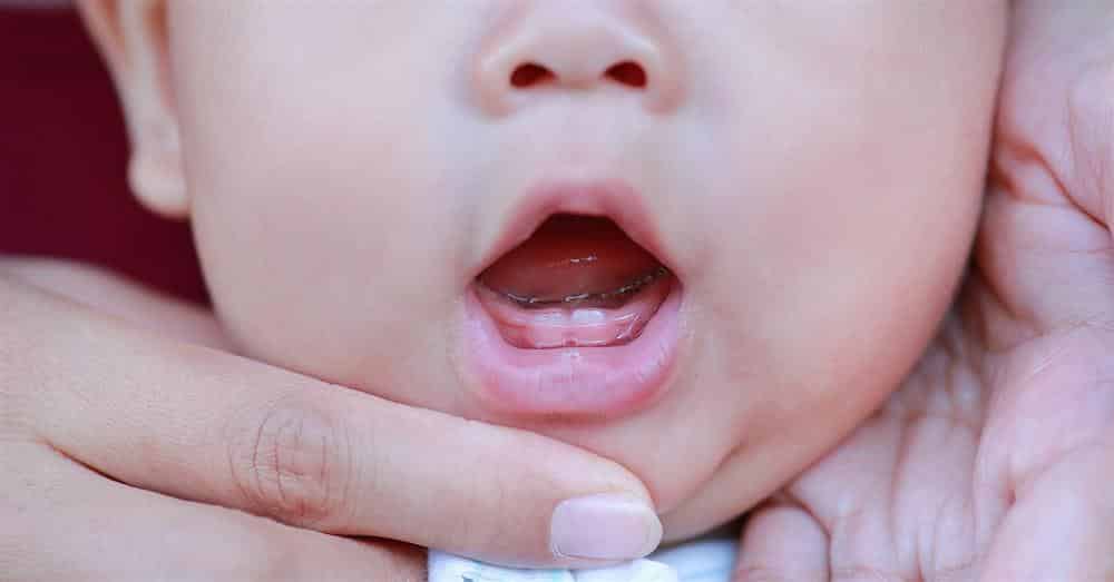 dentição infantil 2 anos sintomas